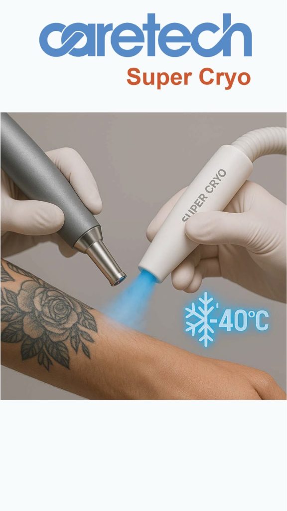 Fraktionaalinen CO₂-laserhoito poistaa tatuoinnit